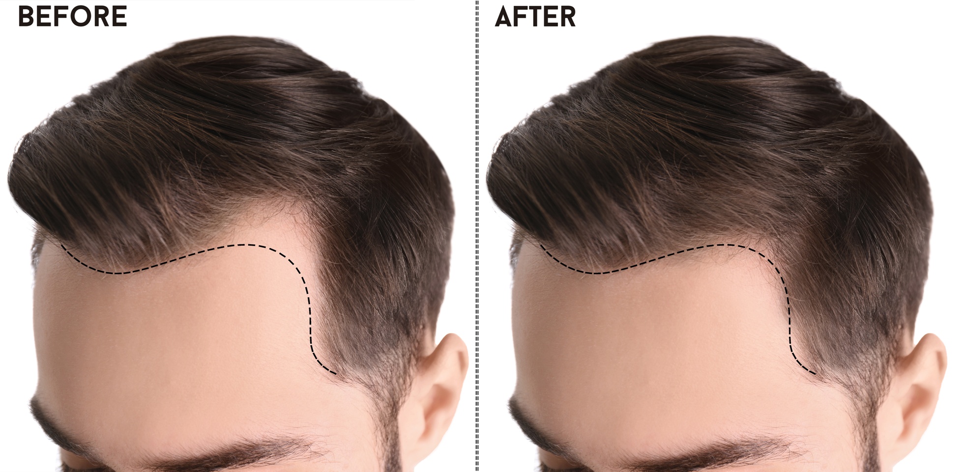 Hair loss and men’s health treatment at Leslie Medical Pharmacy